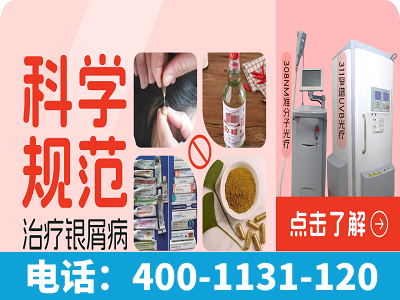 苏州哪个医院看银屑病